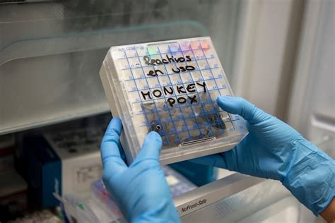 Monkeypox: Philadelphia vaccine shortages won't immediately be helped ...