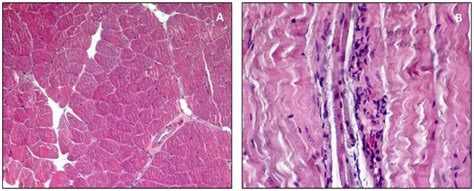 Morphological and Functional Aspects of Human Skeletal Muscle