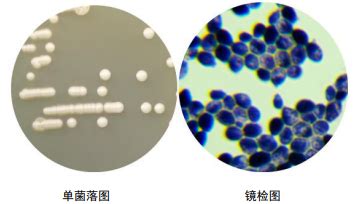 白色念珠菌 BNCCBNCC263676 微生物菌种|北纳生物