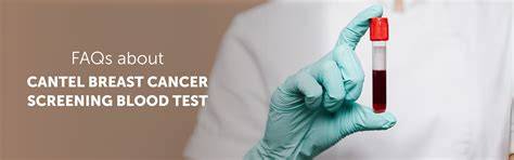 FAQ – Cantel Test