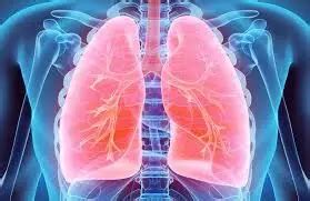 Extremely preterm infants show persistent airway obstruction during ...