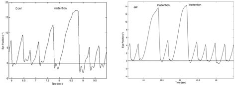 A Unifying Model-Based Hypothesis for the Diverse Waveforms of ...