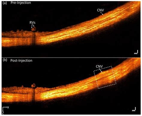 Gold Nanoparticles as Contrast Agents in Ophthalmic Imaging