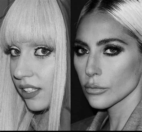 Lady Gaga Before Nose Job