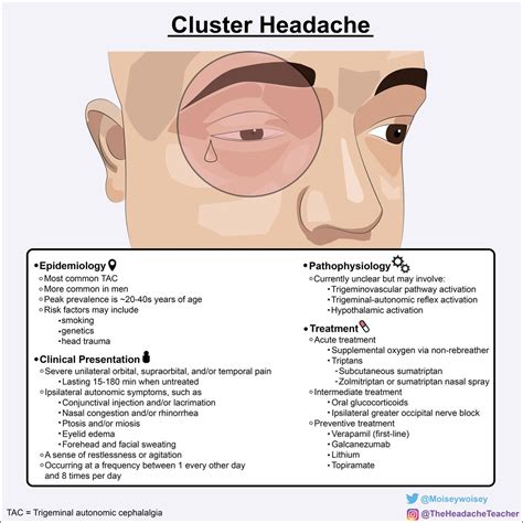 1/ Cluster headache is the most common trigeminal autonomic cephalalgia ...