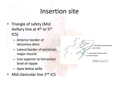 Chest tube insertion ppt (surgery) | PPTX