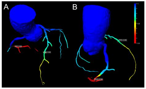 Coronary Computed Tomography vs. Cardiac Magnetic Resonance Imaging in ...