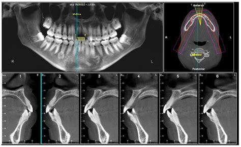 Cone-Beam Computed Tomography in Orthodontics