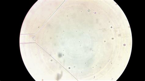 Microfluidics‭ Device to Measure Stiffness of Blood Cells‬ | IITBombay