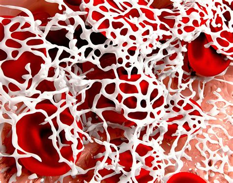 Image result for Fibrinogen Test Procedure