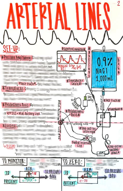 Arterial Line DIGITAL DOWNLOAD ICU Nurse Reference (Download Now) - Etsy - step to zero