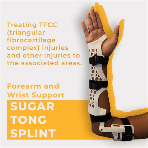 Sugar Tong Splint