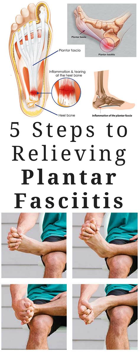 Pin on Plantar Fasciitis Treatment, Exercises, Symptoms and Causes