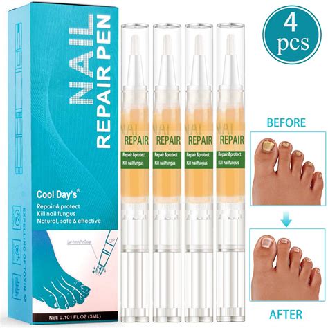 Nail Fungus Treatment Nail Fungus Stop Maximum Strength Anti Fungal ...
