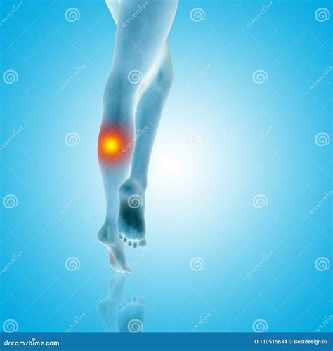 Woman Girl Legs Feet Hurt Calf Pain Ache Closeup Stock Illustration - Illustration of female ...