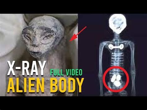 Alien X-ray 的图像结果