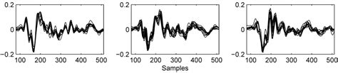 Classification of Sperm Whale Clicks (Physeter Macrocephalus) with ...