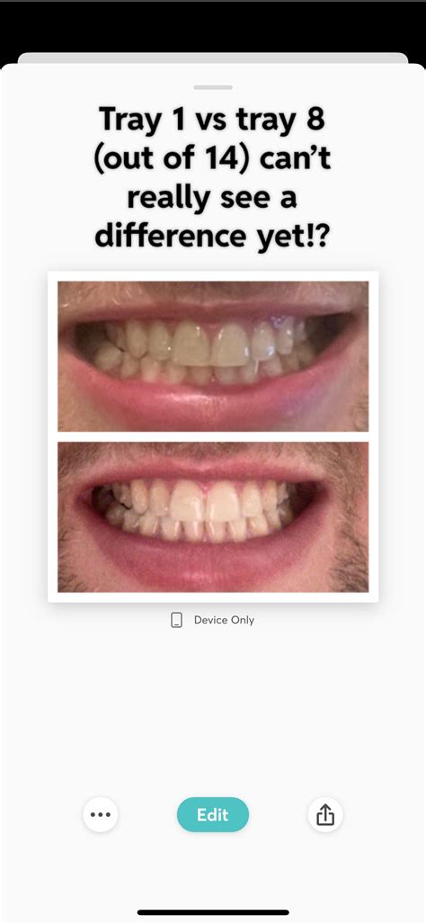 Tray 1 vs tray 8 (out of 14) can’t really see a difference yet!? : r ...