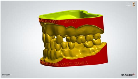 Modular Digital and 3D-Printed Dental Models with Applicability in ...