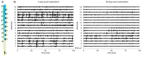 Silicon-Based Microfabrication of Free-Floating Neural Probes and ...