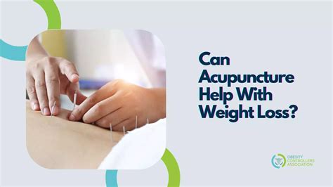 Acupuncture Chinese Medicine Weight Loss at Charlotte Stretton blog