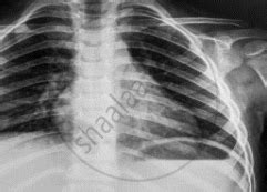 Find the Cutoff Wavelength for the Continuous X-rays Coming from an X ...