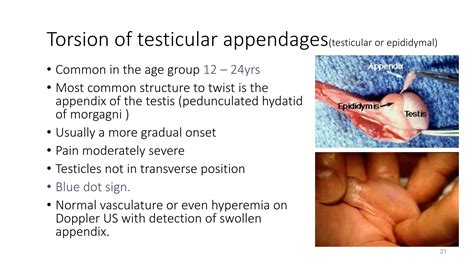 Scrotal and Testicular Swelling.pptx
