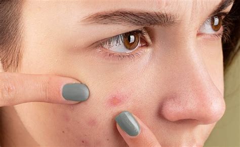 स्किन केयर रूटीन में इन 5 चीजों को शामिल करना पड़ सकता है भारी, त्वचा ...