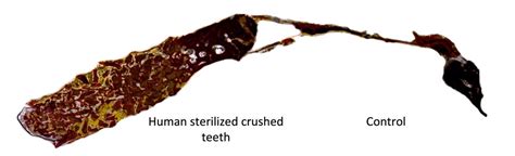 The Use of Human Sterilized Crushed Tooth Particles Compared with BTCP ...