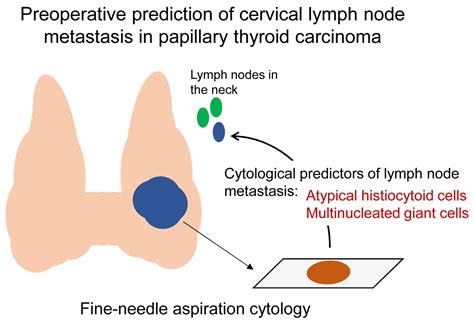 Atypical Histiocytoid Cells and Multinucleated Giant Cells in Fine ...