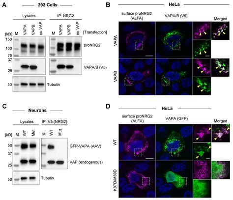 ER-PM Junctions on GABAergic Interneurons Are Organized by Neuregulin 2 ...