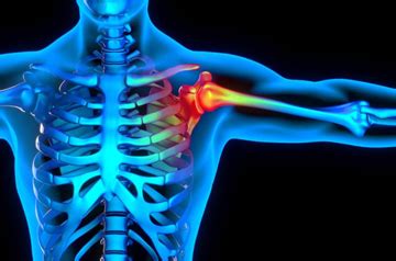 SLAP Tear Surgery in Rajasthan | Shoulder Ortho Care 2026