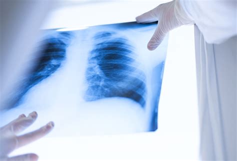 Northwell opens two new medical imaging schools | Northwell Health