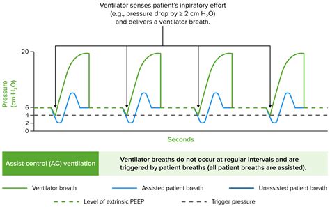 Ventilação Mecânica Invasiva | Concise Medical Knowledge