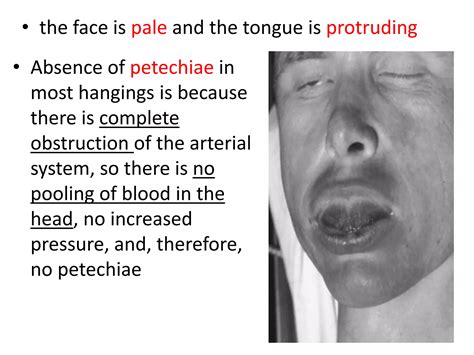 Image result for Strangulation Compression