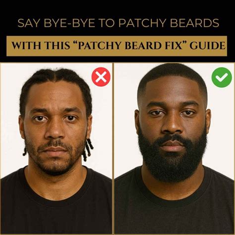 4 Simple Fixes That Solved Patchy Beards in Black Men
