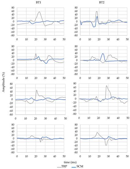 Study of the Emergency Braking Test with an Autonomous Bus and the sEMG ...