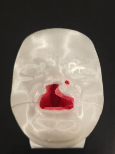 Cleft Lip and Palate Model | V-Invent