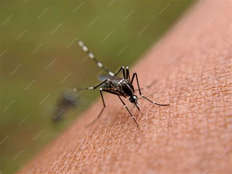 Image result for Insect Removal From Humans