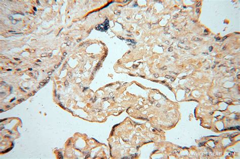 AKAP14 antibody (14622-1-AP) | Proteintech