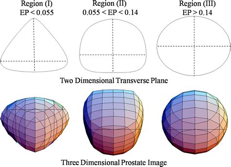 Evaluation of Prostate Volume by Transabdominal Ultrasonography With ...