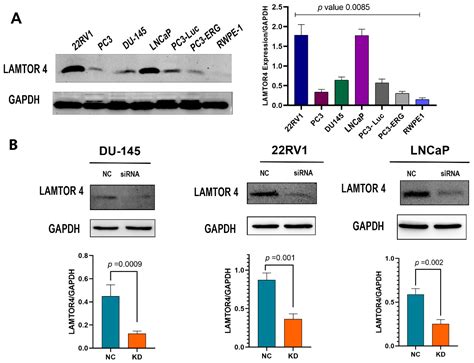 Elevated LAMTOR4 Expression Is Associated with Lethal Prostate Cancer ...