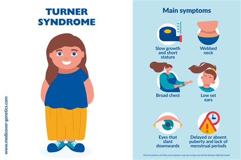 Turner Syndrome Is Autosomal Monosomy