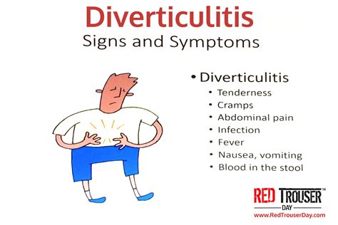 Diagnosis And Management Of Acute Diverticulitis