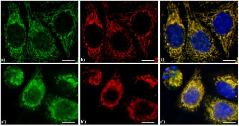 Cells | Special Issue : Apoptosis