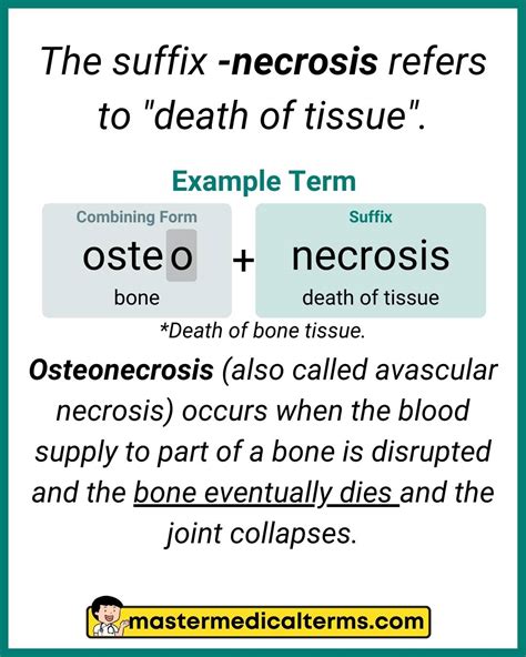 Osteo Medical Term Postmenopausal Osteoporosis | New England Journal