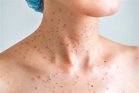 Revathi Hospital Salem - Skin Care | Dermatology | ENT Care | Plastic ...
