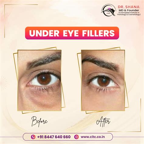 Effective Under Eye Treatment in Pune | CITC Cosmoplast