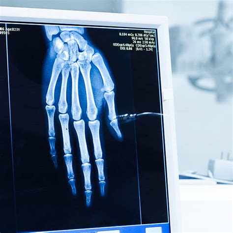 Image result for High-Resolution Hand MRI