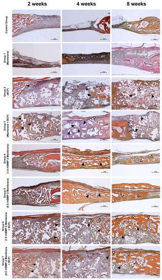 JFB | March 2023 - Browse Articles